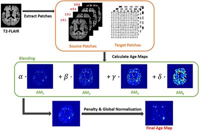 Dilated Saliency U-Net for White Matter Hyperintensities Segmentation Using Irregularity Age Map